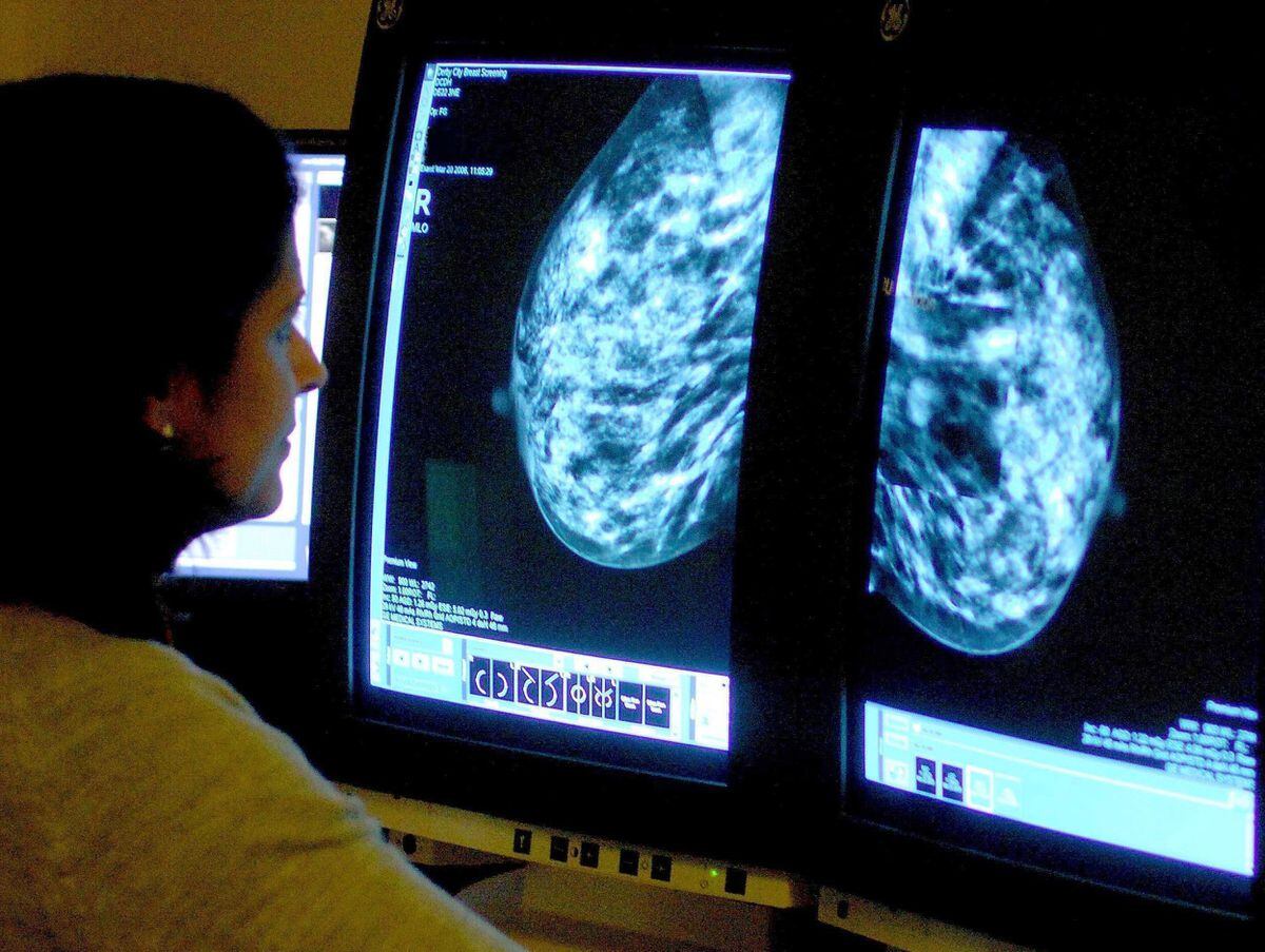 Un Consultant Analyse Une Mammographie.  Photo : Rui Vieira/Pa Wire