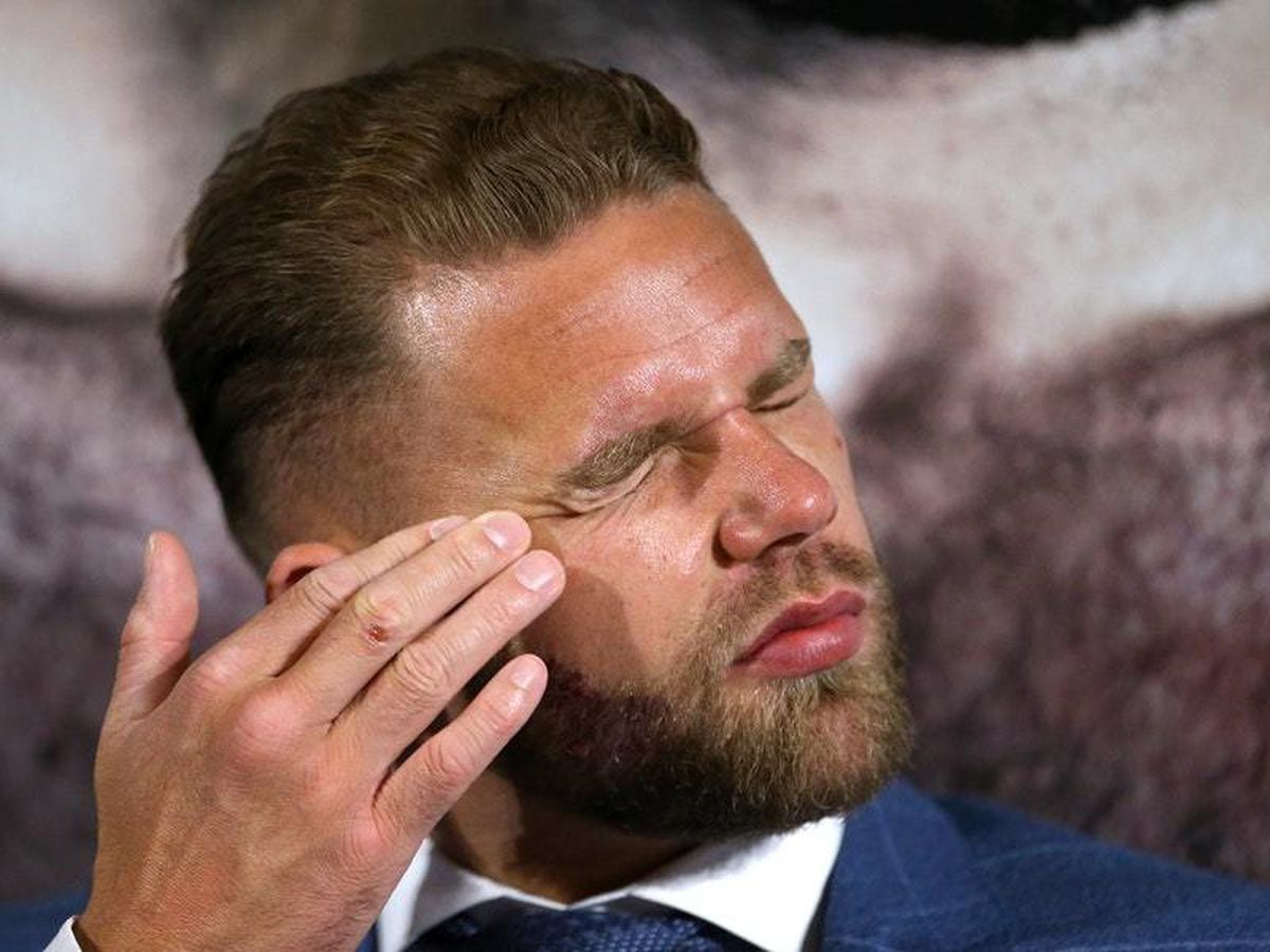 Billy Joe Saunders Charged With Misconduct Over Sickening Video Shropshire Star