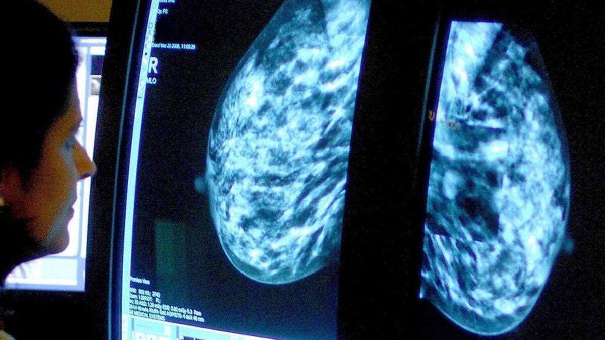 ‘Breakthrough’ drugs approval offers hope for breast cancer sufferers ...