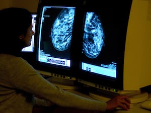 Woman looking at cancer screening images on a computer