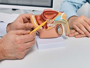 A doctor demonstrating where the prostate is to a patient