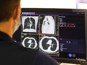 A member of staff looks at the results of a lung scan